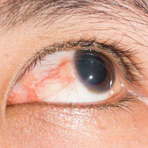 eye